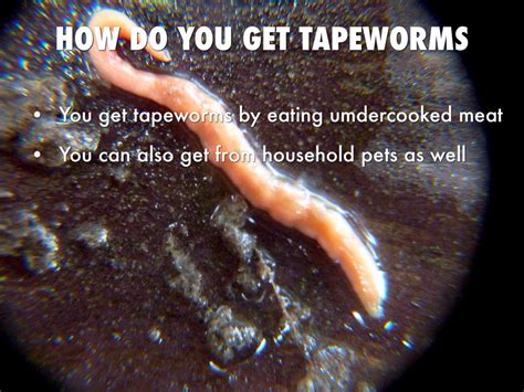 Where Can I Buy Tapeworms Toxoplasmosis