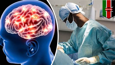 Surgery Gone Wrong Brain Surgeon Operates On Wrong Patient Doh