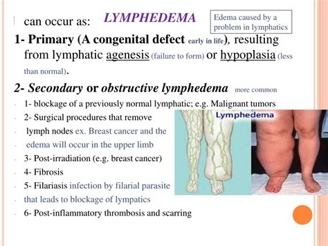 Ppt Veins And Lymphatics Powerpoint Presentation Free Download Id