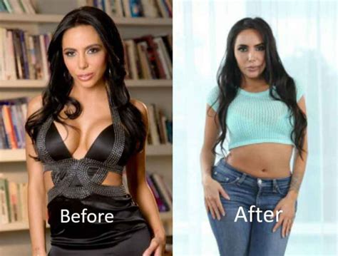 Lela Star Plastic Surgery Before And After Butt Implant Facelift