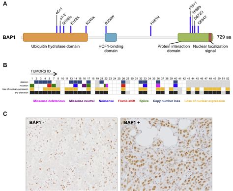 Bap1 Is Altered By Copy Number Loss Mutation Andor Loss Of Protein