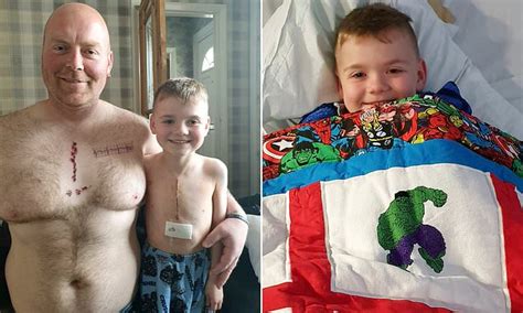 Doting Father Gets Matching Tattoo Of His Six Year Old Son S Six Inch Scar