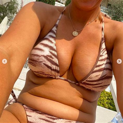 Vicky Pattison Proudly Shows Off Stretch Marks And Cellulite In
