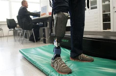 Worlds First Feeling Leg Prosthesis Offers Hope To Amputees