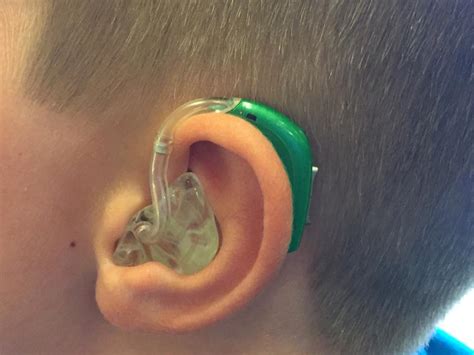 A Silent Problem Childrens Hearing Aids Are Not Covered By Most