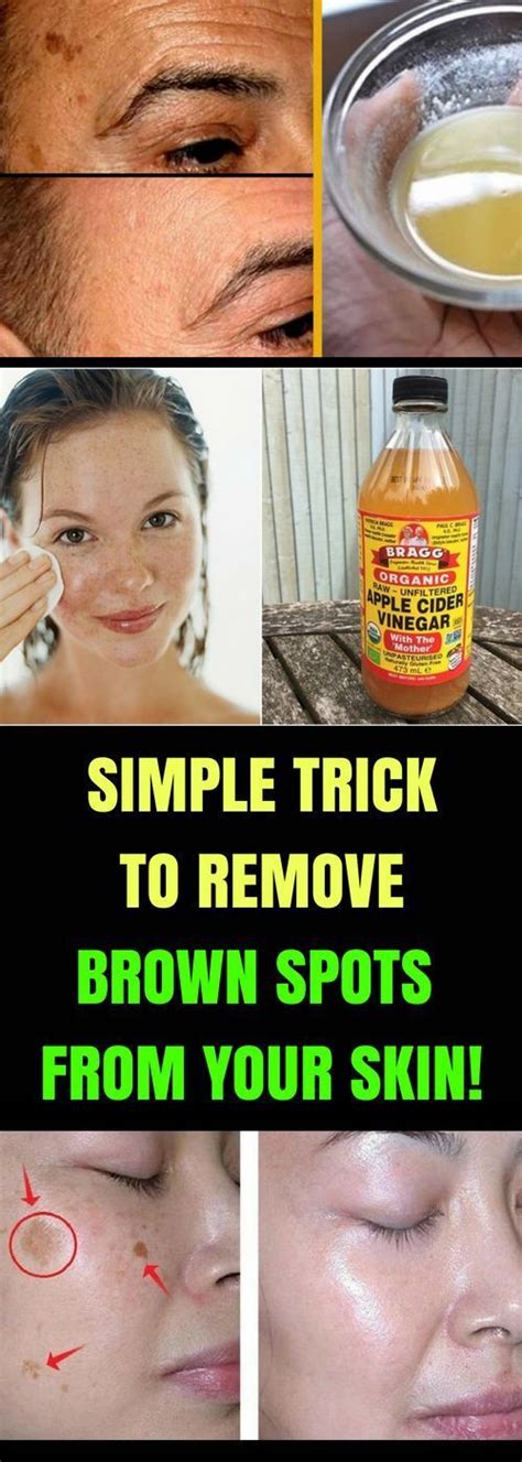 Let Start Slim Today Simple Trick To Remove Brown Spots From Your Skin