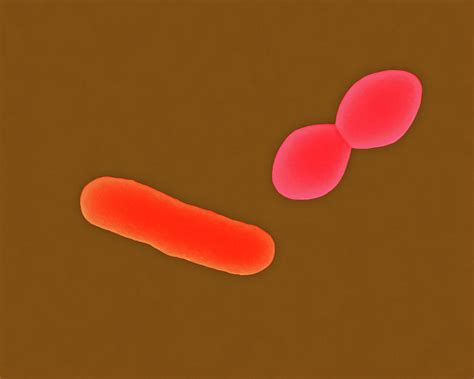 Streptococcus Pneumoniae Photograph By Dennis Kunkel Microscopy Science Sexiz Pix