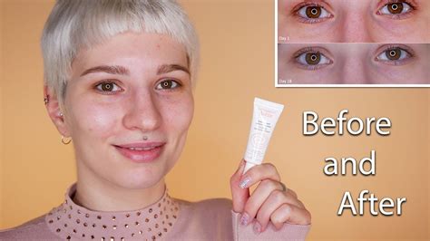 Avene Soothing Eye Contour Cream Before And After Youtube