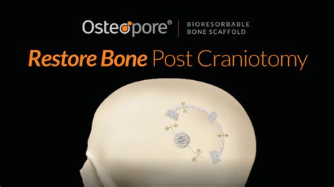Osteopore Bioresorbable Bone Scaffold Ad Appearing In Journal Of
