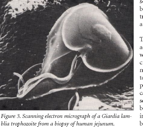 Giardia Lamblia Electron Microscope Micropedia