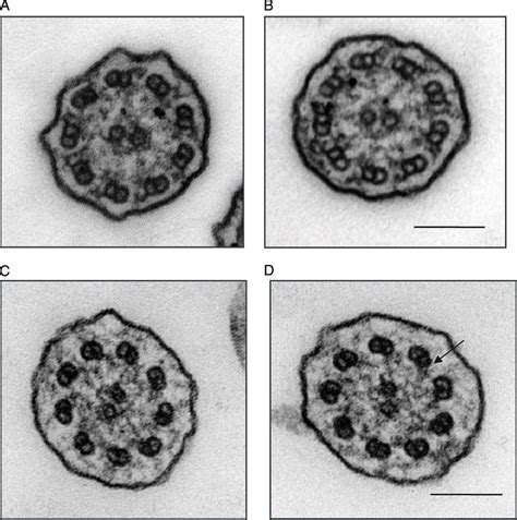 Transmission Electron Microscope Cross Sections Of Ciliary Axonemes