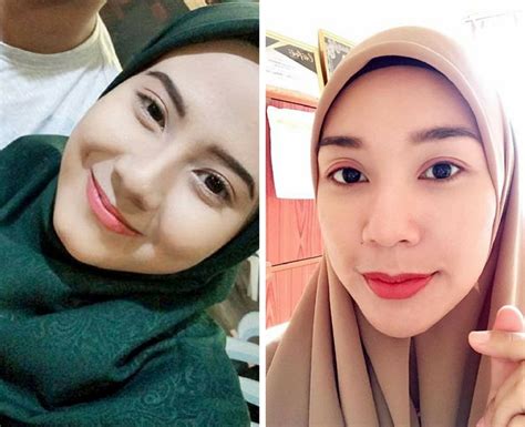 Kini, semakin ramai yang menjualnya secara online. Ubat Kecutkan Jerawat - Pertanyaan m