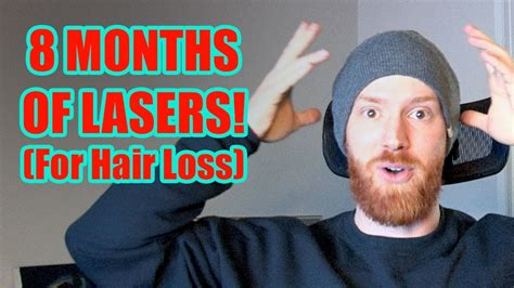 8 Month Results From Low Level Laser Therapy Lllt For Hair Loss Youtube