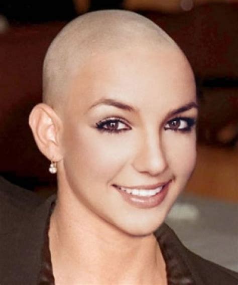 Albums 93 Pictures Pictures Of Bald Woman Latest