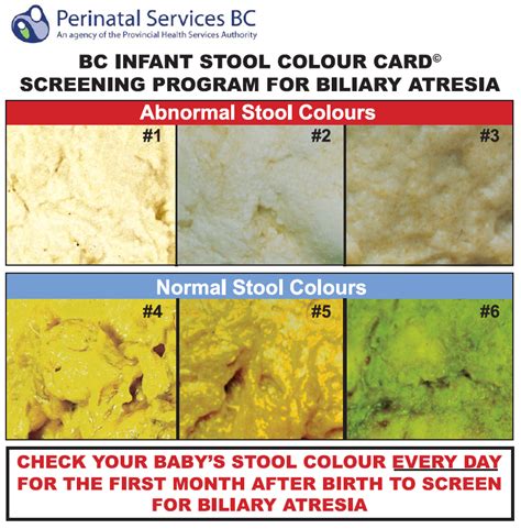 Blanket Check Car Seat Check Poop Colour Chart Huh Ubc Faculty