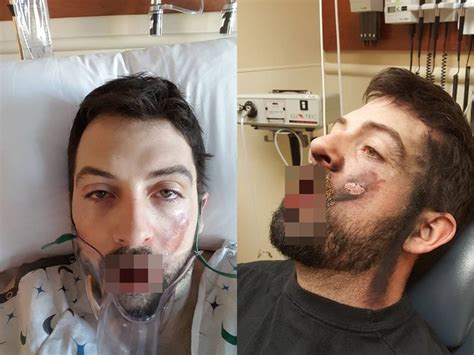 Namun tariza ariezky bisa dikatakan beda dari yang lain. Vape Meledak Di Indonesia / Top 10 Largest Vape Vapor ...