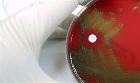 Emergence Of Streptococcus Pneumoniae Serotype 15a After The