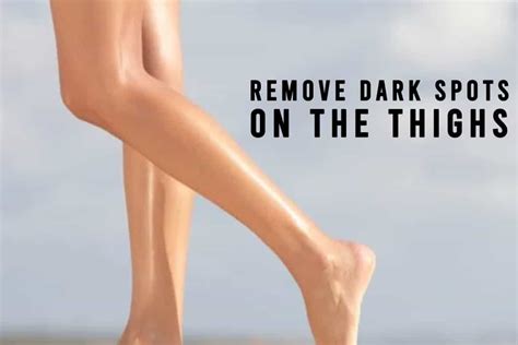Natural Remedies To Remove Dark Spots On The Thighs Go Lifestyle Wiki