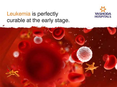 Leukemia Is Perfectly Curable At The Early Stage