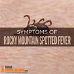 rocky mountain spotted fever Archives
