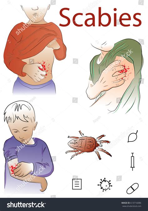 4543 Scabies Images Stock Photos And Vectors Shutterstock