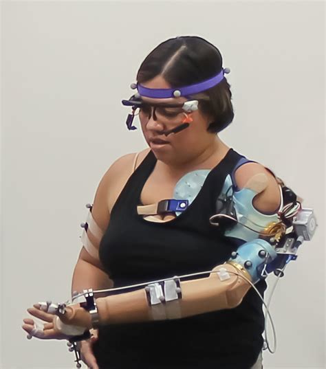Futuristic Bionic Arm Helps Amputees Feel The Sensation Of Touch And