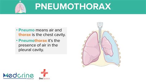 Pneumothorax Definition Types And Classification Preview Youtube