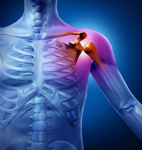 Sciatica Back Pain Disc Problems Neck Pain Shoulder Pain Sports