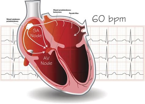 Arytmia Serca Objawy Arytmii Serca