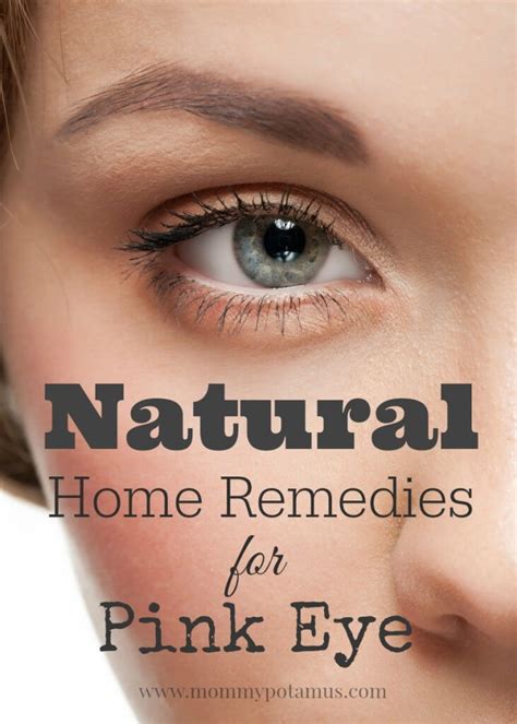 5 Natural Remedies For Pink Eye