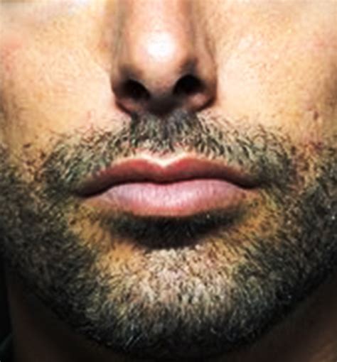 Lbumes Foto Que Significa Morderse Los Labios En Un Hombre Lleno