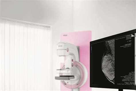 Southwest Health 3d Digital Mammography