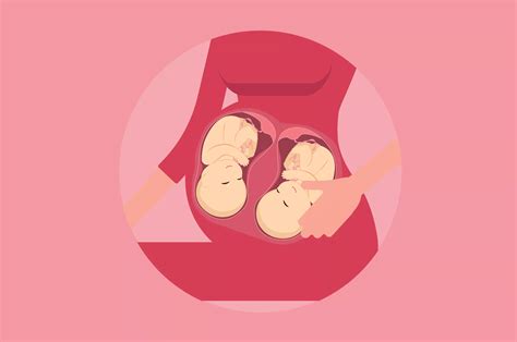 Ibu Hamil Perlu Tahu Tanda Mengalami Air Ketuban Berlebihan