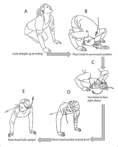 Epley Maneuver Illustration