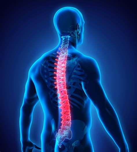 Back And Spinal Injuries Personal Law Btmk Solicitors