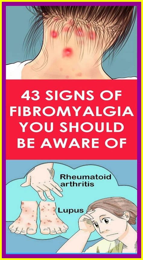 Signs Of Fibromyalgia You Should Be Aware Of Body Tips Signs Of