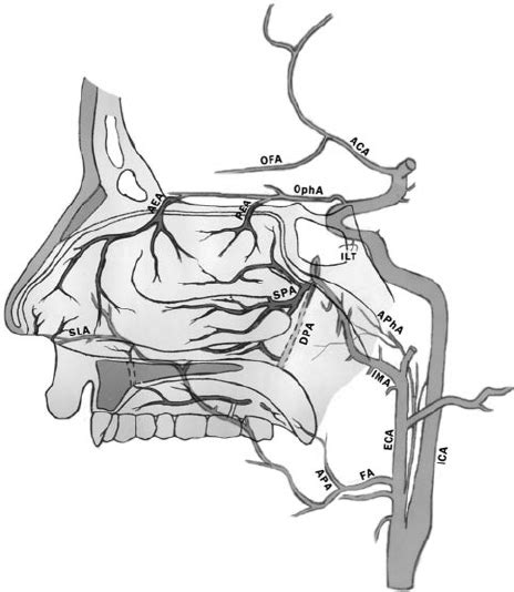 Schematic Representation Of Normal Arterial Anatomy Of The Sinonasal