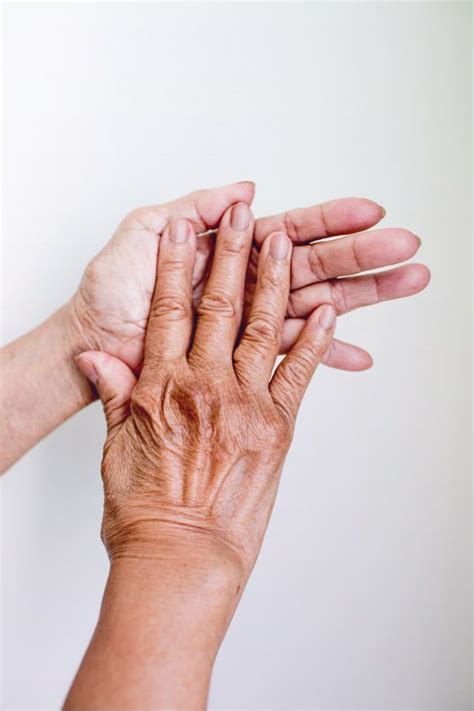 9 Early Signs And Symptoms Of Rheumatoid Arthritis Kesehatan
