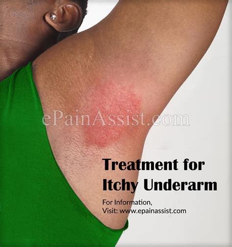 Treatment For Itchy Underarm Or Ways To Get Rid Of Itching In Armpits
