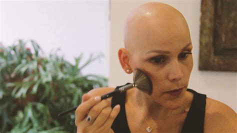 Mi Historia Con La Alopecia Universal Catalina Ortega M Youtube