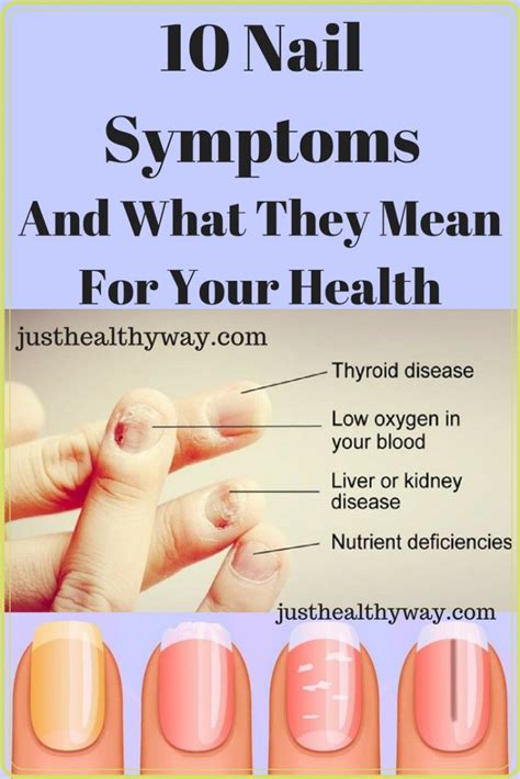 10 Nail Symptoms And What They Mean For Your Health Fingernail Health
