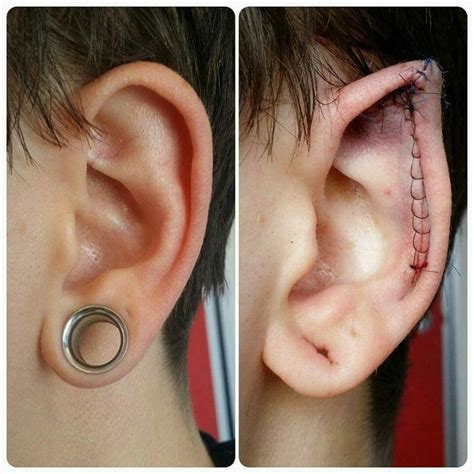 Fans have been turning to body modification artists. 9 best Ear Pointing images on Pinterest | Body ...