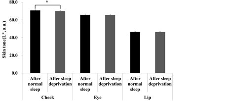 The Effects Of Sleep Deprivation On The Biophysical Properties Of