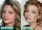 Michelle Pfeiffer Plastic Surgery Before and After Nose Job - Lovely ...