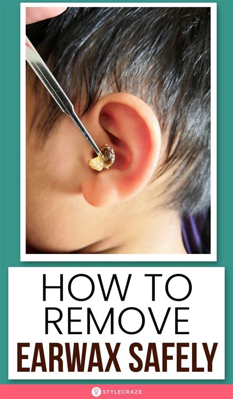 15 Effective Home Remedies To Remove Ear Wax Safely Ear Health Ear