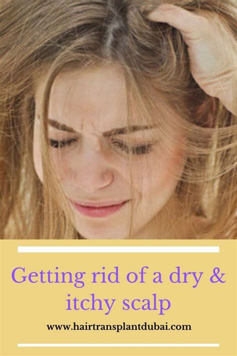 Getting Rid Of A Dry And Itchy Scalp Health Nigeria