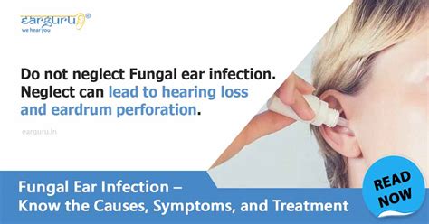 Causes Symptoms And Treatment Of Fungal Ear Infection