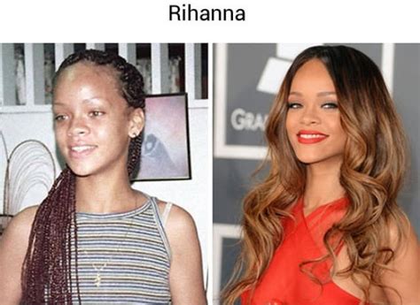 Celebrities Before They Became Famous 28 Pics