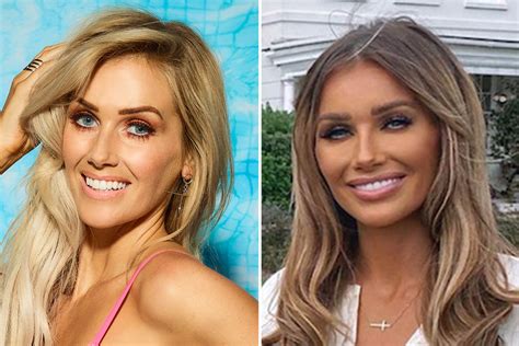 Love Island Fans Stunned By Laura Andersons Transformation The
