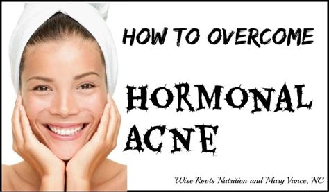 How To Overcome Hormonal Acne Mary Vance Nc